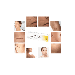 Contractubex Gel pour l'élimination des cicatrices Original 100%