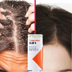 Caspiselen Kin Shampooing Antipelliculaire 200 ml